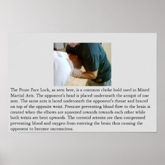 フロント顔ロックまたはフロントチョーク ポスター