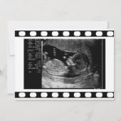 ブラック&ホワイトフィルムの超音波写真 ベビーシャワー 招待状 (裏面)
