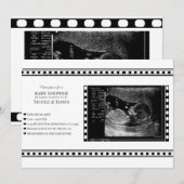 ブラック&ホワイトフィルムの超音波写真 ベビーシャワー 招待状 (正面/裏面)