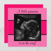 プリンセスベビーカスタマイズ超音写真テンプレート 招待状 (正面/裏面)