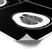 ヘッドのCTスキャン ポスター (角)