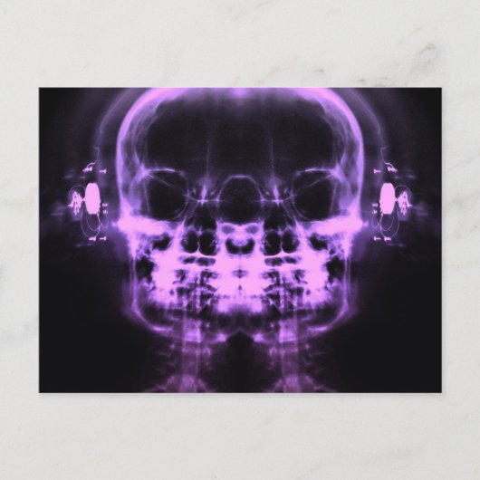 ヘッドフォン付きダブルX線スカル – 紫 ポストカード (正面)