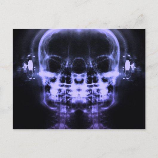 ヘッドフォン付きダブルX線スカル – 紫 ポストカード (正面)
