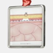 ヘルニアのイラストレーション メタルオーナメント (左)