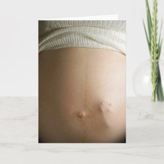 ベビーの隆起 カード