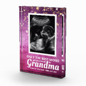 ベビーガール超音波妊娠告知 フォトブロック (右)