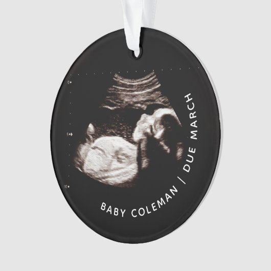 ベビークリスマスオーナメント妊娠超音波写真 オーナメント (正面)
