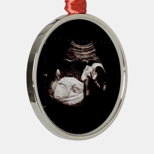 ベビークリスマス妊娠超音波写真クラス メタルオーナメント (右)