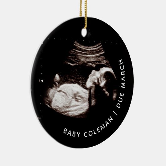 ベビークリスマス来妊娠間近の写真 セラミックオーナメント (右)