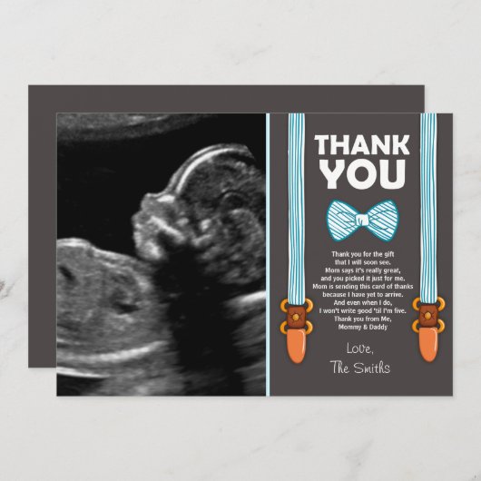 ベビーシャワーのサンキューカードの小さい人のエコー サンキューカード (正面/裏面)