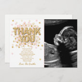 ベビーシャワーのサンキューカードの紙吹雪の金ゴールドのピンクの女の子 サンキューカード (正面/裏面)