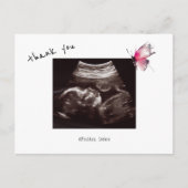 ベビーシャワー 超音波検査 キュートな蝶のサンキューカード ポストカード (正面)