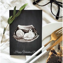 ベビーシンプルは幸せ来なバレンタインデーのプレゼント シーズンカード