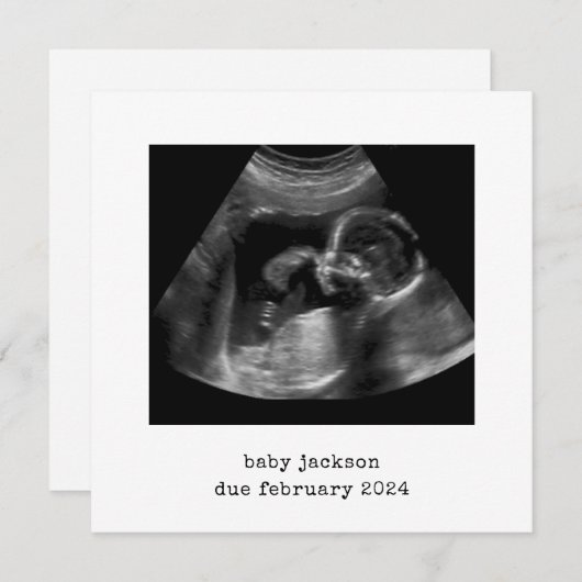 ベビースキャン写真アナウンスメントカード シーズンカード (正面/裏面)