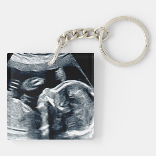 ベビーソノグラパーソナライズされたム期待パディ キーホルダー (裏面)