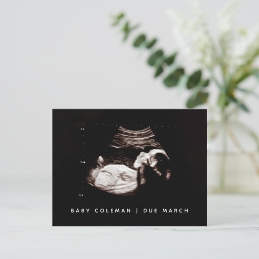 ベビーソノグラム妊娠到着発表写真 ポストカード (スタンド正面)