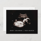 ベビーソノグラム妊娠到着発表写真 ポストカード (正面/裏面)