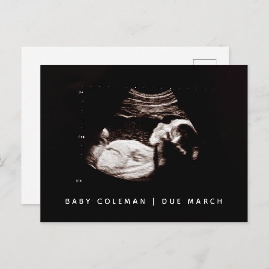 ベビーソノグラム妊娠到着発表写真 ポストカード (正面/裏面)