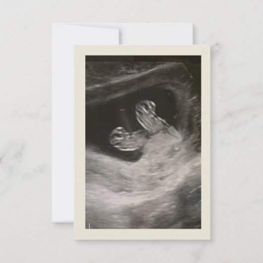 ベビーツインズ発表 案内状 (裏面)