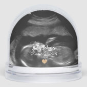 ベビー来ズSoonSonogram金ゴールドハート (正面)