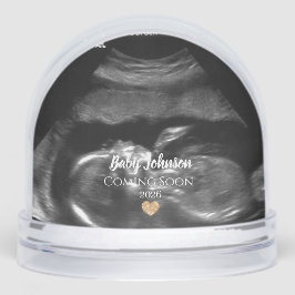 ベビー来ズSoonSonogram金ゴールドハート