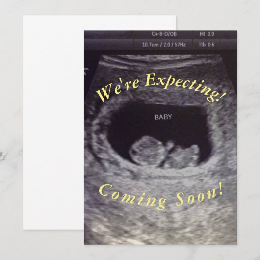 ベビー発表 案内状 (正面/裏面)