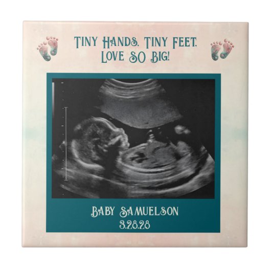 ベビー超音波キープサムギフトボックス タイル (正面)