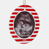 ベビー超音波写真レッドホワイトストライプクリスマス セラミックオーナメント (右)