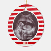 ベビー超音波写真レッドホワイトストライプクリスマス セラミックオーナメント (左)