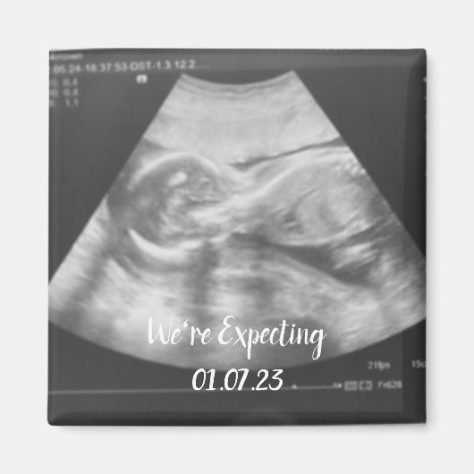 ベビー超音波告知 マグネット (正面)