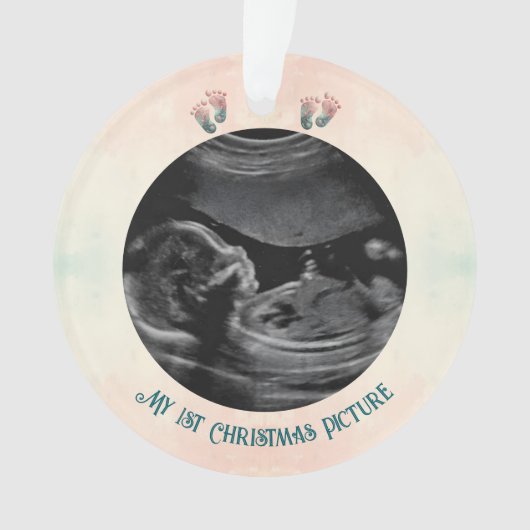 ベビー超音波第1クリスマス期待オーナメント オーナメント (正面)