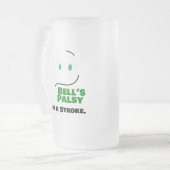 ベルの麻痺 – 脳卒中ではない –  フロストグラスビールジョッキ (正面左)