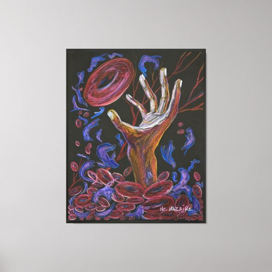 ホープ – 鎌状赤血球痛認識度 キャンバスプリント (正面)