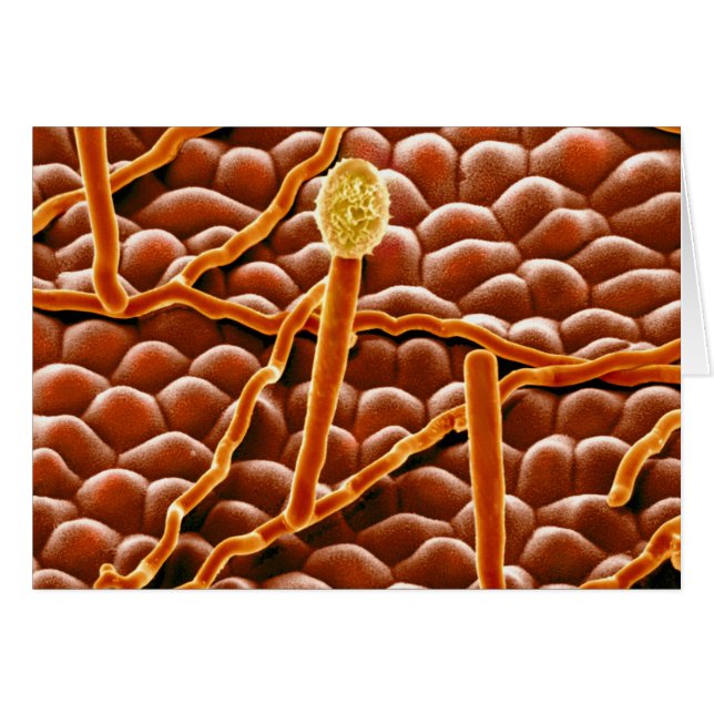 ポインセチアのうどんこ病の菌類 (正面横)