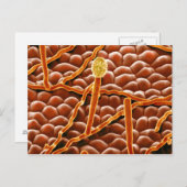 ポインセチアのうどんこ病の菌類 ポストカード (正面/裏面)