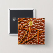 ポインセチアのうどんこ病の菌類 缶バッジ (正面&裏面)