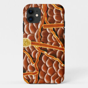 ポインセチアのうどんこ病の菌類 iPhone 11 ケース