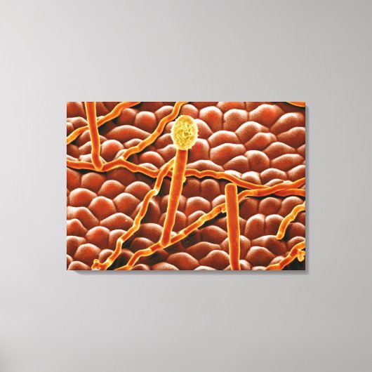 ポエステチアの粉状カビ キャンバスプリント (正面)