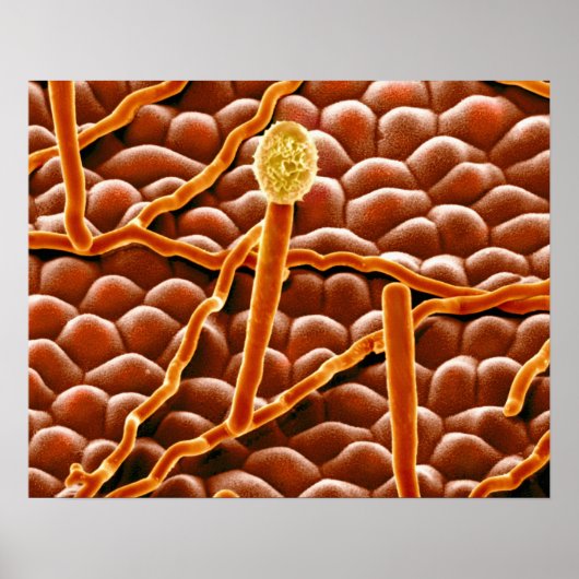 ポエステチアの粉状カビ ポスター (正面)