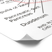 ポスター胆道システム図グラフ胆嚢 ポスター (角)