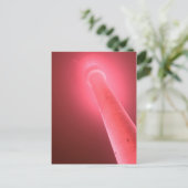 ポストカルテ – ピンクショット ポストカード (スタンド正面)