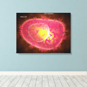 マスト細胞の顕微鏡的見解 キャンバスプリント (インサイチュ (ウッドフロア))