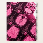 マゼンタMRI：脳の軸視 プランナー手帳 (裏面)