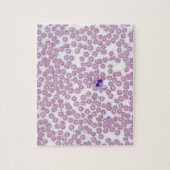 マラリア血液細胞 ジグソーパズル (縦)