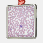 マラリア血球 メタルオーナメント (左)