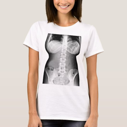 メス体X線スケルトン写真イメージ Tシャツ (正面)