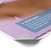 メラロジック過色素沈着医療ポスター ポスター (角)