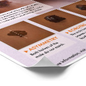 メラロジーメラノーマ医療ポスター ポスター (角)