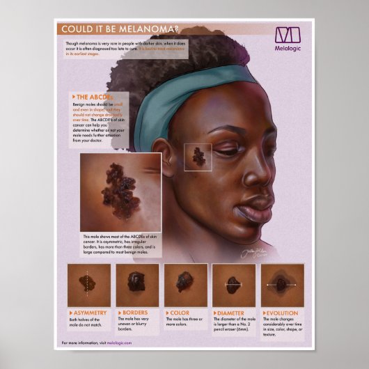 メラロジーメラノーマ医療ポスター ポスター (正面)