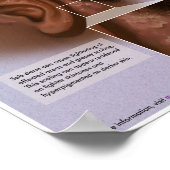 メロ脂漏性皮膚炎（ダンドルフ）医学 ポスター (角)